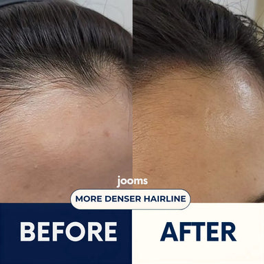 Jooms™ 2% Deoxyribose Scalp Serum